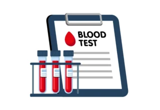 How Long Do Blood Test Results Take in Ireland